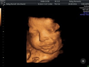 34 WKS 4d ultrasound scan berkshire 